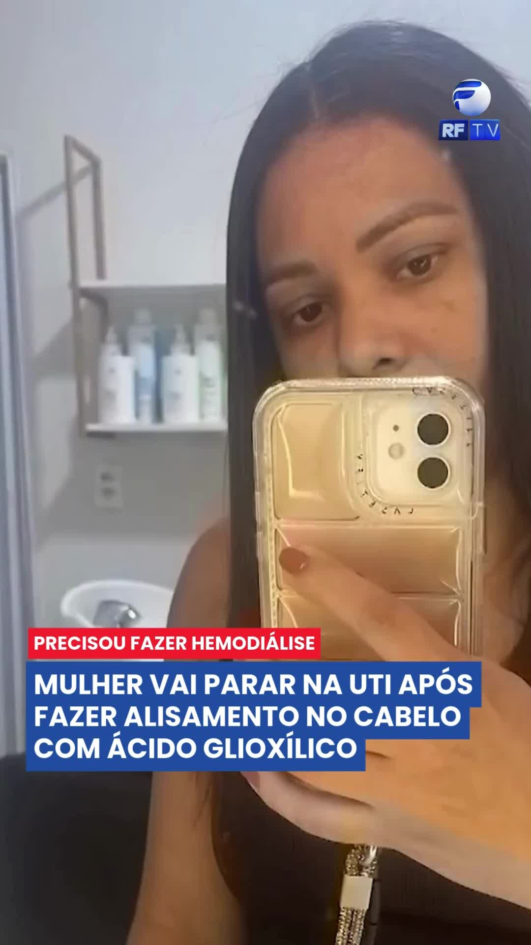 🚨 ALERTA: ALISAMENTO TERMINA EM UTI 🚨
Adrieli, de Fortaleza (CE), foi internada na UTI após usar um produto de alisamento capilar com ácido glioxílico — substância não autorizada pela Anvisa para esse tipo de uso no Brasil.
Quatro dias após o procedimento, ela sentiu fortes dores nas costas e precisou de hemodiálise após sofrer complicações nos rins. Adrieli ficou sete dias hospitalizada.
⚠️ Fique atento(a): sempre verifique a composição dos produtos e procure profissionais qualificados.
#Alerta #Saúde #AlisamentoCapilar #Anvisa #Cosméticos #Fortaleza