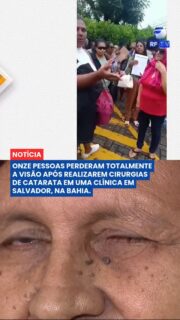 ⚠️ Cirurgias de catarata deixam pacientes cegos após mutirão em Salvador
Um caso grave está sendo investigado em Salvador. Pelo menos 11 pessoas perderaam totalmente a visão após passarem por cirurgias de catarata em uma clínica particular da capital baiana.
De acordo com as informações iniciais, 138 procedimentos foram realizados no mesmo dia durante um mutirão. Após as cirurgias, diversos pacientes começaram a apresentar infecções oculares graves. Além dos casos de cegueira, outros 14 pacientes também tiveram complicações e infecção nos olhos.
As autoridades de saúde investigam o que pode ter causado as complicações, incluindo possíveis falhas nos protocolos de higiene, esterilização de equipamentos ou uso de medicamentos contaminados.
Os pacientes afetados estão recebendo acompanhamento médico, e o caso segue sob investigação.
Hashtags:
#Salvador #Bahia #Saúde #CirurgiaDeCatarata #AlertaNaSaúde Investigação Notícia Brasil Jornalismo