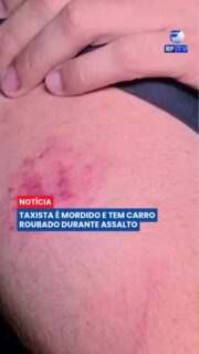 🚨 TAXISTA É MORDIDO DURANTE ASSALTO E CRIMINOSO CAPOTA CARRO ROUBADO EM SP
Um taxista viveu momentos de terror após ser atacado por um criminoso que fingiu ser passageiro em São Paulo. Depois de finalizar uma corrida, o motorista percebeu o comportamento suspeito do homem e tentou evitar problemas, mas acabou sendo agredido.
Durante a luta corporal, o assaltante deu socos e chegou a morder o braço do taxista antes de roubar o veículo e fugir. O criminoso percorreu cerca de 15 quilômetros até perder o controle da direção, bater em outro carro e capotar o táxi roubado.
A polícia prendeu o suspeito após o acidente. Apesar de recuperar o veículo, o motorista ficou com prejuízos materiais e emocionais e precisará interromper temporariamente o trabalho.
#SãoPaulo #Taxista #Assalto #Polícia #Violência #Crime #Segurança #Brasil #Jornalismo