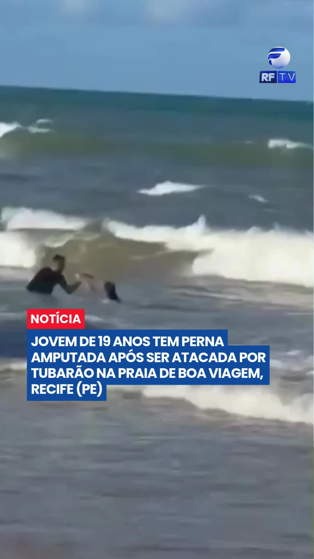 JOVEM TEM PERNA AMPUTADA APÓS ATAQUE DE TUBARÃO EM RECIFE

Uma jovem de 19 anos foi atacada por um tubarão na praia de Boa Viagem, em Recife (PE), enquanto estava com a água na altura da cintura. Ela foi socorrida, passou por cirurgia, mas precisou ter uma das pernas amputada devido à gravidade dos ferimentos.

O ataque aconteceu em uma área sinalizada com placas de alerta para a presença de tubarões. Este é o quarto caso registrado em Pernambuco neste ano e o segundo em apenas dois dias. No último domingo, um menino de 11 anos também foi atacado na região e teve a perna amputada.

#Tubarão #Recife #BoaViagem #Pernambuco #AtaqueDeTubarão #Litoral #Segurança #Brasil #Notícias #RFTV