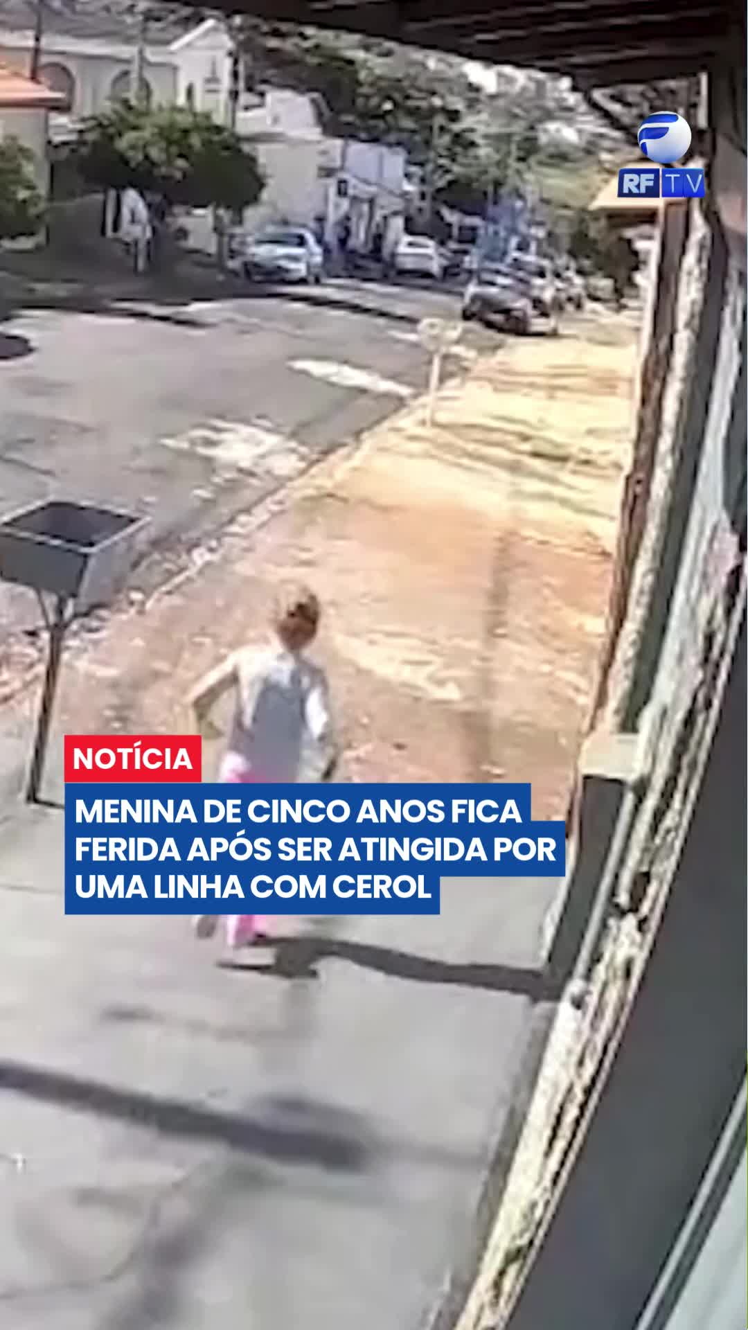 MENINA DE 5 ANOS FICA FERIDA APÓS SER ATINGIDA POR LINHA COM CEROL

Uma menina de apenas 5 anos ficou ferida após ser atingida por uma linha de pipa com cerol na Grande São Paulo. A criança caminhava pela calçada quando a linha enroscou em seu pescoço, causando ferimentos graves.

Ela foi socorrida às pressas para uma unidade de saúde e precisou levar cinco pontos devido aos cortes. O caso reforça o alerta sobre os perigos do uso de cerol e de linhas cortantes, que continuam colocando em risco a vida de crianças, motociclistas e pedestres.

#Cerol #LinhaComCerol #Segurança #GrandeSãoPaulo #Acidente #Conscientização #Notícias #Criança #Brasil #PortalDeNotícias
