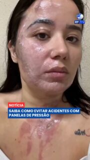 A panela de pressão faz parte da rotina de milhões de brasileiros, mas o uso inadequado do utensílio pode provocar acidentes graves. Especialistas alertam que a manutenção e o manuseio corretos são fundamentais para garantir a segurança durante o preparo dos alimentos.
Antes de utilizar a panela, é importante verificar a borracha de vedação, a válvula de segurança e o pino de saída de vapor. Também é essencial respeitar o limite máximo de alimentos e líquidos indicado pelo fabricante e nunca tentar abrir a panela enquanto ainda houver pressão interna.
Pequenos cuidados no dia a dia ajudam a evitar acidentes e tornam o preparo das refeições muito mais seguro para toda a família.
#Segurança #PanelaDePressão #Cozinha #Prevenção #Casa #Dicas #Brasil #Atualidades #Notícias