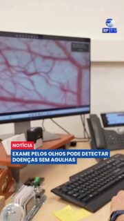 Pesquisadores israelenses desenvolveram uma tecnologia que pode revolucionar a medicina. Utilizando inteligência artificial e uma câmera de alta resolução, o sistema analisa os vasos sanguíneos da conjuntiva — a membrana que cobre a parte branca dos olhos — para identificar alterações no organismo.

Nos testes iniciais, a ferramenta alcançou cerca de 90% de precisão na detecção de anemia, sem a necessidade de coleta de sangue ou uso de agulhas. O exame é realizado em poucos segundos e pode facilitar o acompanhamento de pacientes no futuro.

Agora, os pesquisadores trabalham para aumentar a precisão do método e obter aprovação dos órgãos reguladores. A expectativa é que a tecnologia possa ser utilizada até mesmo em casa para monitorar a saúde de forma rápida e prática.

#Saúde #Tecnologia #Inovação #InteligênciaArtificial #Israel #Medicina #Ciência #Anemia #Notícias