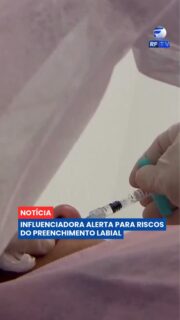 O desejo de mudar a aparência pode trazer benefícios para a autoestima, mas também exige planejamento e segurança 💄
Uma influenciadora usou as redes sociais para relatar as complicações que enfrentou após um preenchimento labial e chamou atenção para a importância de buscar profissionais capacitados. Especialistas destacam que a avaliação prévia, a utilização de produtos regulamentados e o acompanhamento após o procedimento são etapas fundamentais para reduzir intercorrências.
Embora seja considerado um procedimento minimamente invasivo, o preenchimento labial não é isento de riscos. Por isso, a orientação é esclarecer todas as dúvidas antes da aplicação e seguir rigorosamente as recomendações do profissional responsável.
Na sua opinião, as redes sociais ajudam ou atrapalham na decisão de realizar procedimentos estéticos? 👇
#RFTV #PortalVeloz #Brasil #Estetica #Noticias #Brasil