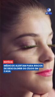 A nova tendência de descolorir os cílios em casa tem viralizado nas redes sociais, mas acende um alerta grave entre profissionais de saúde. A prática envolve o uso de produtos químicos como água oxigenada e pó descolorante bem próximos à região dos olhos.

Oftalmologistas e dermatologistas advertem que esses compostos podem causar queimaduras químicas, reações alérgicas severas, irritação nas pálpebras e danos permanentes à visão e à estrutura dos fios. Por ser uma área extremamente sensível, especialistas enfatizam que não existe quantidade segura dessas substâncias para uso ocular, contraindicando totalmente o procedimento.
#SaudeOcular #Oftalmologia #Dermatologia #CuidadosComOsOlhos #AlertaDeSaude #BelezaSegura #Noticias #Jornalismo