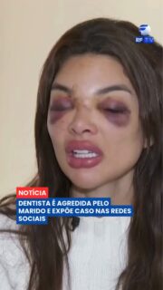 A cirurgiã-dentista Giulia Falcão denunciou o próprio marido por violência doméstica após ser agredida na madrugada de sábado (15), em São Paulo. 🚨
Segundo o relato da vítima, a agressão aconteceu depois que o casal voltou de um jantar. Vizinhos ouviram a confusão e acionaram a polícia. O marido, o empresário Ivo Vel Kos, foi detido e teve a prisão convertida em preventiva.
Giulia também tornou o caso público nas redes sociais, mostrando os ferimentos e relatando que aquela não teria sido a primeira situação de violência durante os quase três anos de casamento. Ela afirmou ainda que era submetida a episódios de manipulação emocional.
Além da investigação por violência doméstica, Ivo também é alvo de apurações relacionadas a possíveis fraudes financeiras.
O caso segue sob investigação das autoridades.
#RFTV #PortalVeloz #SaoPaulo #ViolenciaDomestica #Noticias #Brasil