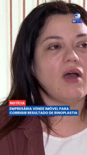 😔 Uma empresária de São Paulo precisou vender uma casa herdada dos pais para custear uma nova cirurgia após um procedimento estético no nariz que, segundo ela, não teve o resultado esperado.
Vanessa viajou para Goiânia em 2021 para realizar uma rinoplastia. De acordo com o relato dela, o resultado foi insatisfatório e deixou sequelas, incluindo dificuldades para respirar. Meses depois, ela tentou buscar reparação com o mesmo profissional, mas a consulta acabou sendo cancelada.
Em 2022, Vanessa assinou um acordo e recebeu de volta os honorários médicos pagos inicialmente, mas afirma que permaneceu sem ressarcimento de custos hospitalares adicionais. Dois anos após a primeira cirurgia, ela precisou vender o imóvel herdado dos pais para financiar uma nova intervenção.
👉 Acompanhe outras histórias e os desdobramentos do caso na RFTV e no Portal Veloz.
#RFTV #PortalVeloz #SãoPaulo #CirurgiaPlástica #Rinoplastia #Saúde